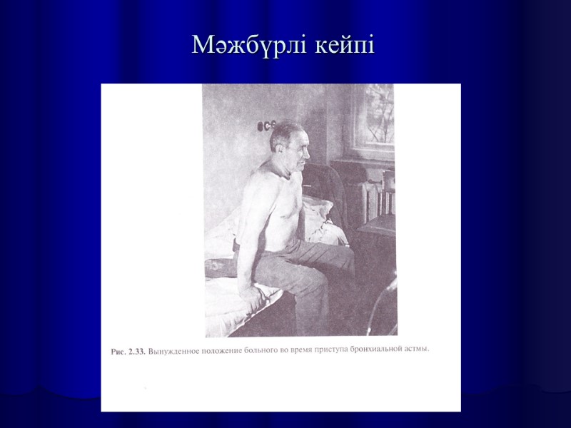 Мәжбүрлі кейпі